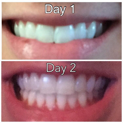 BRIGHTOLOGY™ - Teeth Whitening Powder